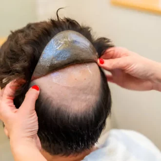 Toupet Haarsystem Haarsystem
